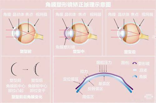 广州眼科咨询免费，快速解答眼部疑惑！超 80%患者咨询后问题得到有效解决 