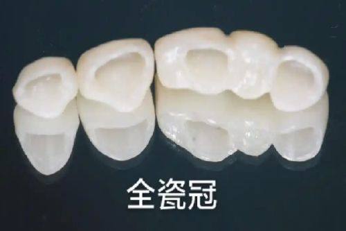 北京口腔哪家好?瑞泰、马泷等私立口腔看牙口碑佳,种牙正畸选对医院更安心