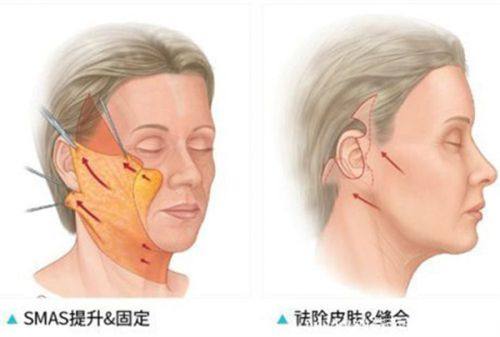 二、珠海爱思特医疗美容医院的技术优势