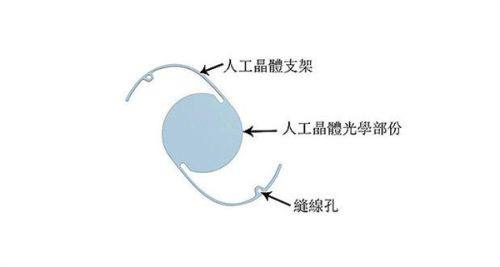 三、珠海爱思特医疗美容医院的服务特色