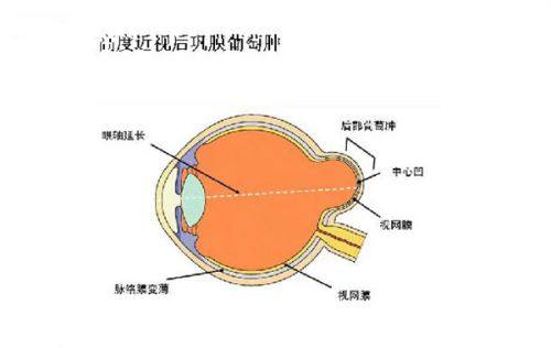 二、北京爱尔英智眼科刘畅医生怎么样