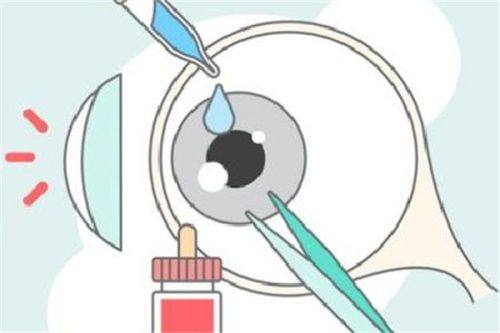 长沙旺旺医院眼科