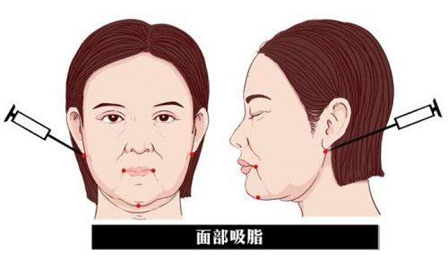 二、深圳艺星医疗美容医院为什么值得选？去过的姐妹都夸