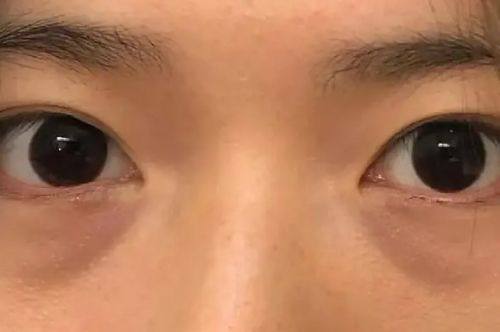 二、深圳艺星医疗美容医院营业时间能给求美者带来哪些便利？