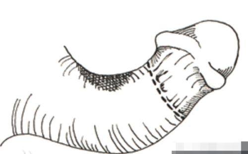 深圳阳光整形医院营业时间公布：周一至周日 9:00 - 18:00，满足爱美的你随时开启变美之旅！ 