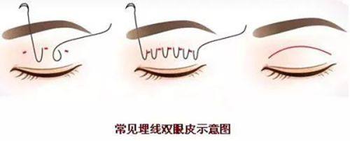 无锡丽都整形医院