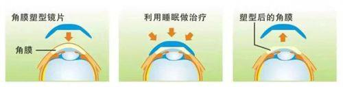 小结:长春眼科医院收费高不高?答案是“合理到让你意外”!