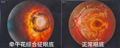 二、上海新视界眼科医院于妍娉怎么样?