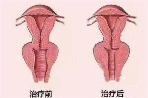 三、南京施尔美整形美容医院的价格体系