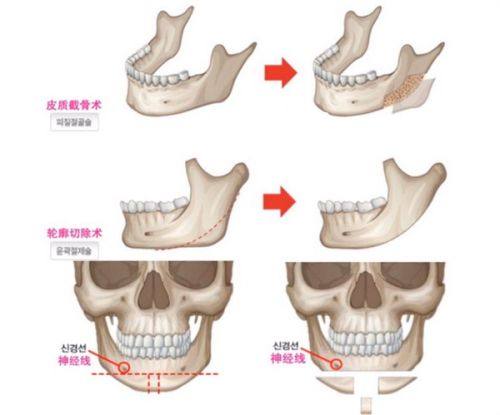 二、南京施尔美整形美容医院怎么样?