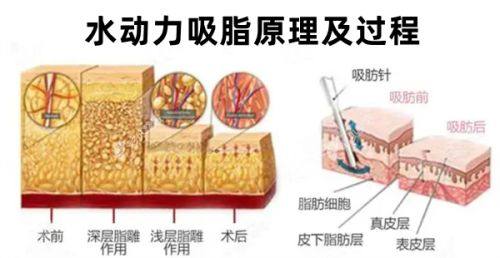 三、南京施尔美整形美容医院的技术优势和医生团队