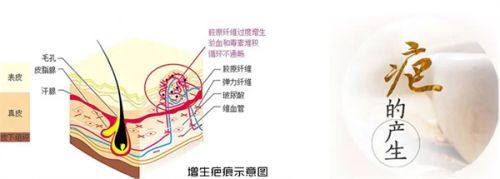 二、苏州美莱美容医院于加平医生怎么样?