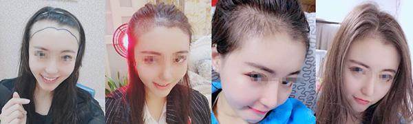 二、合肥曙光植发医院的地址和价格，帮你算笔“明白账”