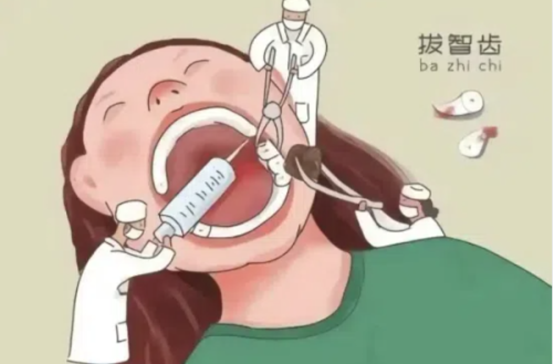 以色列雅定种植体是亲水的吗？部分是亲水种植体，以色列雅定种植体价格表不贵