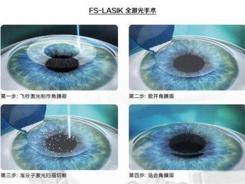 黑龙江普瑞眼科医院在什么位置？位于繁华地段交通便利，专业诊疗团队为您的眼部健康保驾护航 