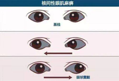 重庆爱成眼科医院怎么样？实力雄厚技术佳，值得患者信赖！ 