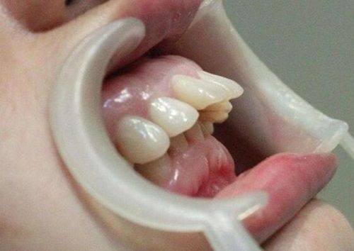 上海瑞伢美口腔收费贵吗？收费合理性价比高，涵盖种植矫正价格详情！ 