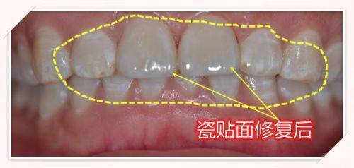 二、北京北区口腔医院技术好吗?实际实例见真章