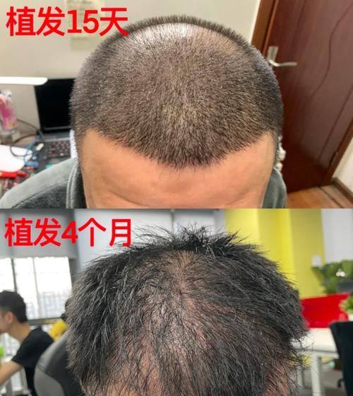 三、做hbw毛囊克隆的医生所在医院价格表