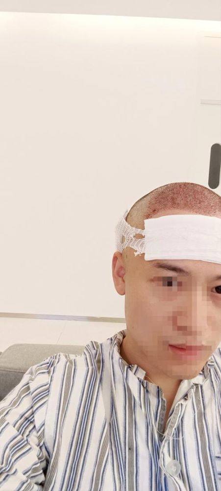 二、做hbw毛囊克隆的医生介绍