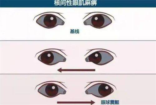 北京民众眼科院长卢宁简历如何？30余年经验技术强，出诊500元享专业眼底诊疗服务 