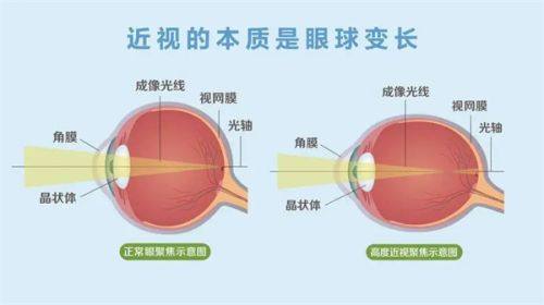 三、王卫群医生手术技术怎么样www.ybbee.com/