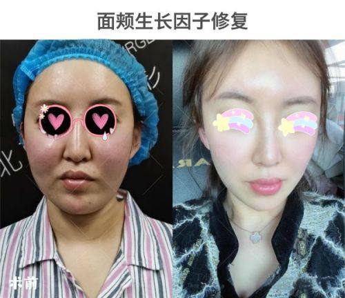 二、杭州时光医疗美容医院吸脂价格情况www.ybbee.com/