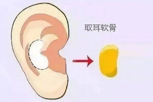 二、东莞韩美美容医院吸脂价格参考www.ybbee.com/