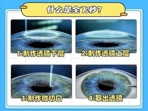 二、鞍山眼科医院挂号网上预约查询：不同情况怎么选号？www.ybbee.com/