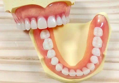 二、意大利BB种植体和韩国种植体的价格差多少？www.ybbee.com/