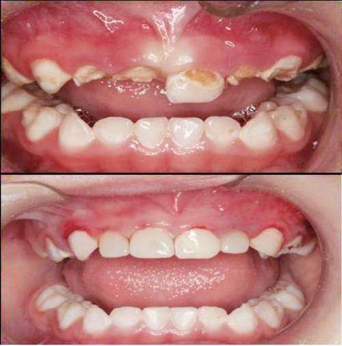 三、深圳华侨医院口腔科地址及预约挂号www.ybbee.com/