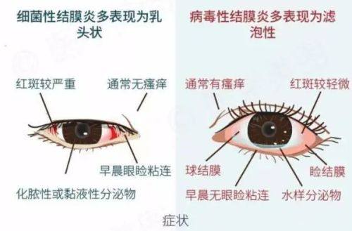 三、近视手术自费与医疗保险治疗的区别www.ybbee.com/