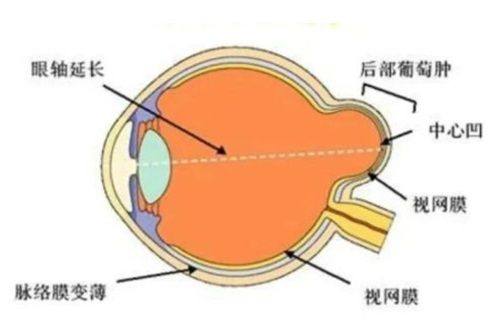 二、昆明眼科专科医院怎么选才不踩雷www.ybbee.com/