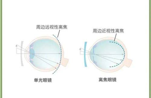 三、术前术后全流程贴心服务指南www.ybbee.com/