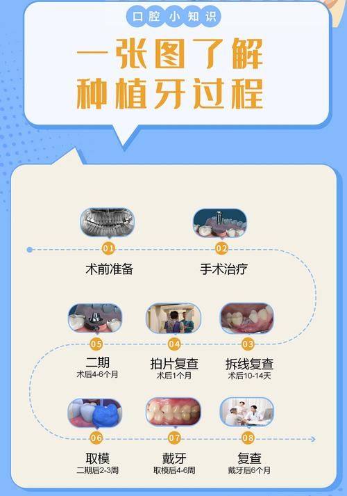二、无锡中诺口腔医院李华磊做穿翼板种植牙技术厉害吗相关价格与预约指南www.ybbee.com/