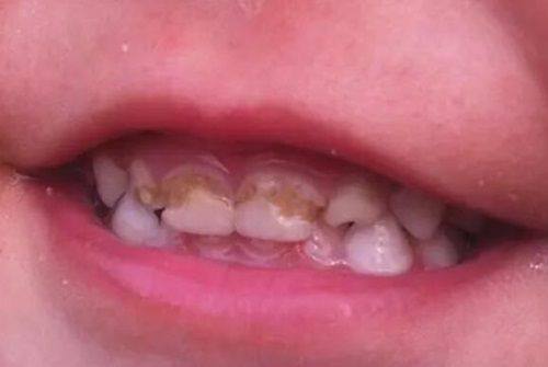 二、武汉华硕口腔的种植院长是谁？擅长解决哪些疑难缺牙？www.ybbee.com/