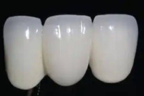 三、在宁德康美诺做种植牙价格贵吗？怎么预约？www.ybbee.com/