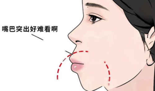 二、宁德康美诺口腔医院的医生团队技术硬不硬？www.ybbee.com/