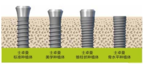 一、宁德康美诺口腔医院种植牙怎么样www.ybbee.com/