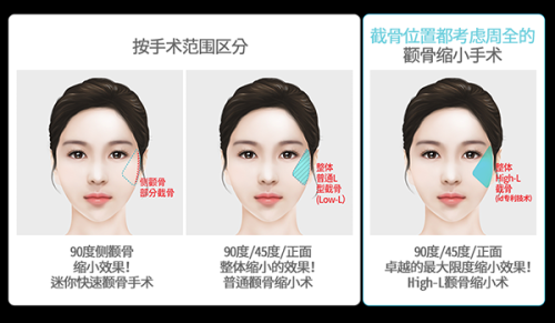 三、找张则福医生做双眼皮多少钱及怎么预约？www.ybbee.com/