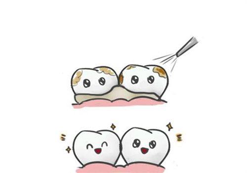 一、深圳格伦菲尔口腔医院牙齿贴面怎么样www.ybbee.com/