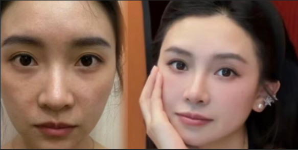 二、厦门美丽星后整形的医生团队靠谱吗？擅长哪些项目？www.ybbee.com/