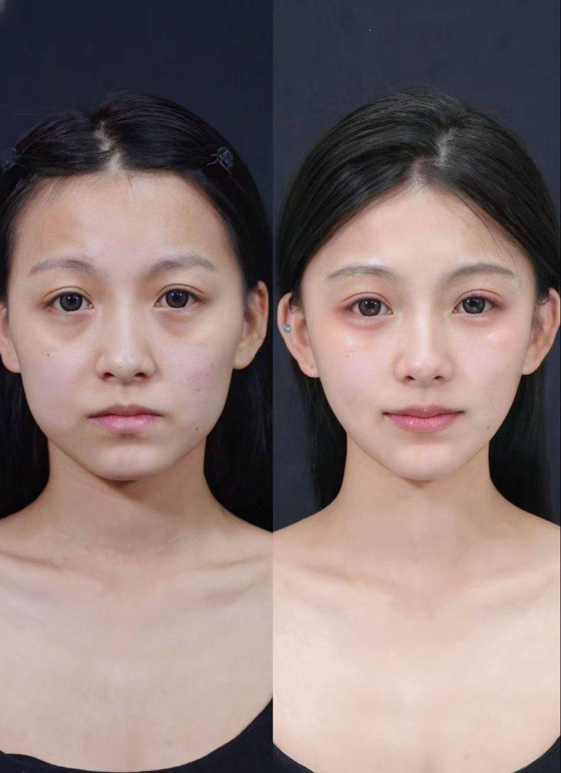 一，主打精细整形！厦门美丽星后整形求美者真实反馈www.ybbee.com/