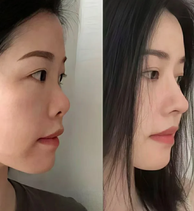 三、想在美丽星后做项目大概要花多少钱及怎么预约？www.ybbee.com/